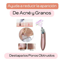 Miles en Paraguay ya lo usan para decirle adiós a los puntos negros y espinillas