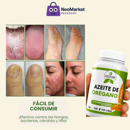 Di Adiós a las Infecciones, Hongos y Fortalece Tus Defensas con Azeite de Orégano
