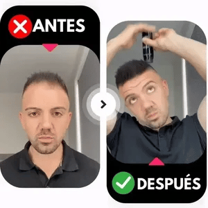 Fibra Capilar ¡Recupera Tu Cabello en Segundos sin Cirugías!