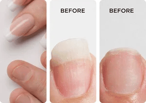 ¡Despídete de las Uñas Quebradizas y Recupera Su Belleza Natural!