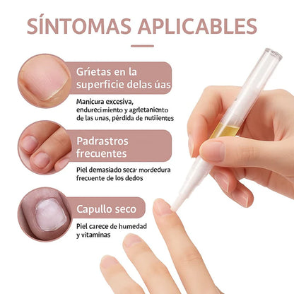 ¡Despídete de las Uñas Quebradizas y Recupera Su Belleza Natural!