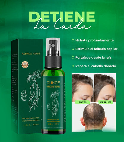 ¡Recupera tu cabello! Detén la caída HOY PAGUE 1 LLEVE 2