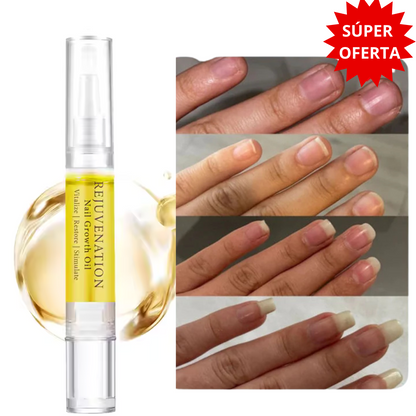 ¡Despídete de las Uñas Quebradizas y Recupera Su Belleza Natural!
