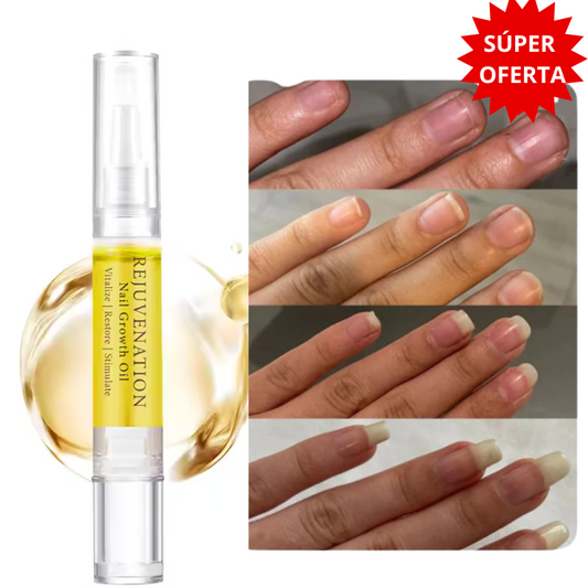 ¡Despídete de las Uñas Quebradizas y Recupera Su Belleza Natural!