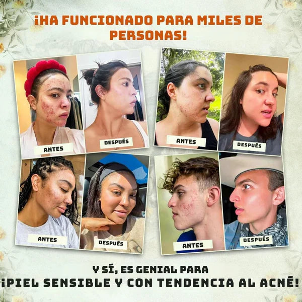 ¡Di adiós a los químicos! Descubre el bálsamo natural para una piel radiante