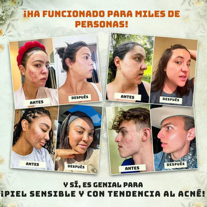 ¡Di adiós a los químicos! Descubre el bálsamo natural para una piel radiante