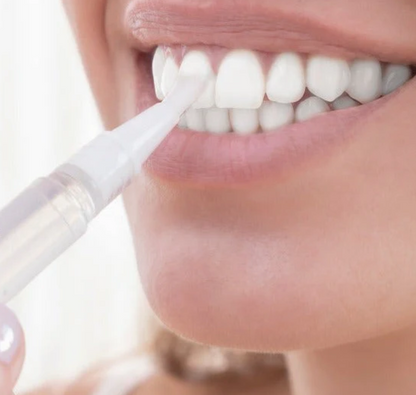 Sonrisa Radiante: Descubre el Blanqueador Dental que Transformará tu Sonrisa