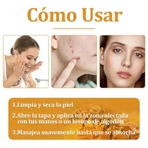 Borra Imperfecciones y Recupera Tu Confianza - PAGA 1 LLEVA 2
