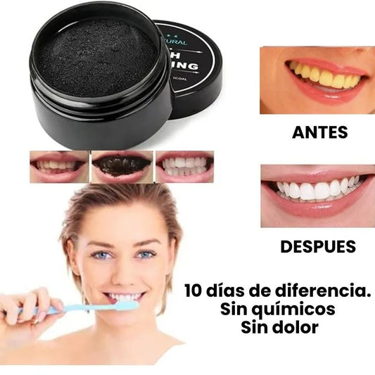 Whitening Carbon – Sonrisa más Blanca De Forma Natural