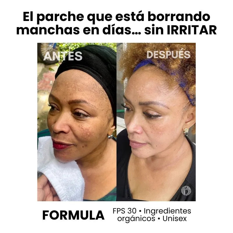 Parche Suave que Elimina Manchas — Ideal para Piel Sensible