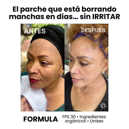 Parche Suave que Elimina Manchas — Ideal para Piel Sensible