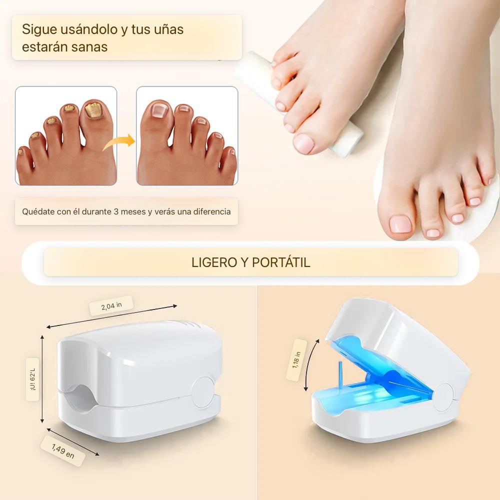 ¡Recupera la Confianza en tus Pies con Nuestro Tratamiento Láser Anti-Hongos En Semanas!