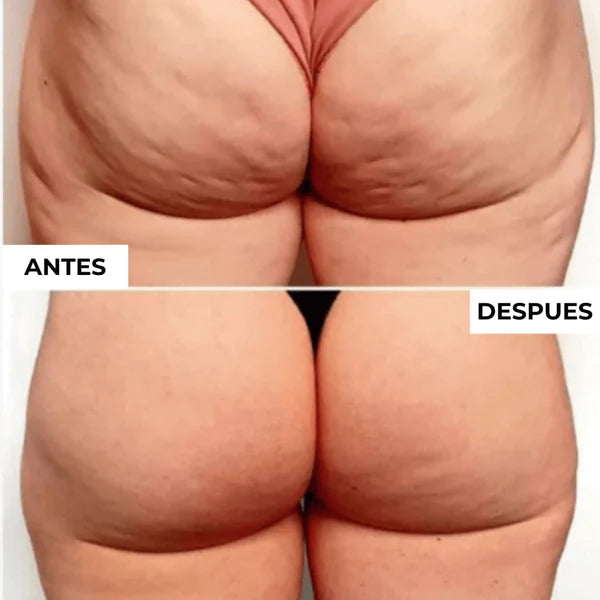 Renueva Tu Cuerpo con Gua Sha: Belleza y Bienestar en Cada Paso