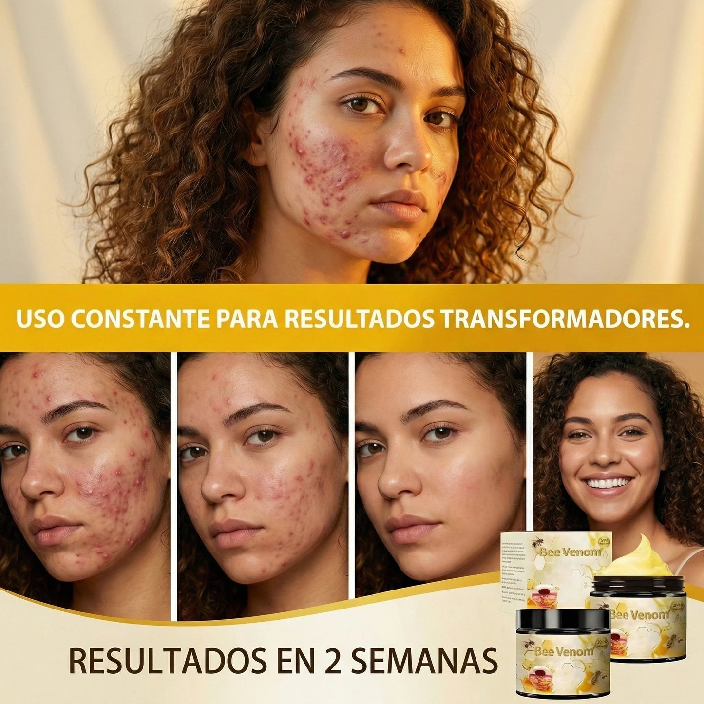 Bee Venom Adiós Acné y Cicatrices
