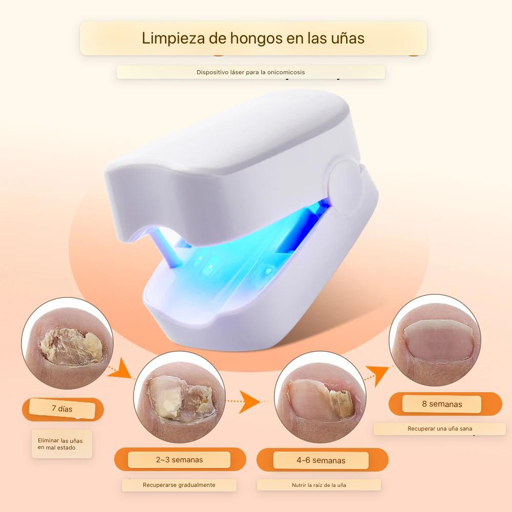 ¡Recupera la Confianza en tus Pies con Nuestro Tratamiento Láser Anti-Hongos En Semanas!