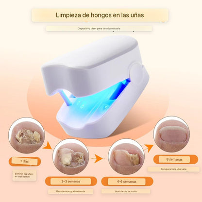 ¡Recupera la Confianza en tus Pies con Nuestro Tratamiento Láser Anti-Hongos En Semanas!