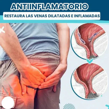 Alivio inmediato y natural para las hemorroides