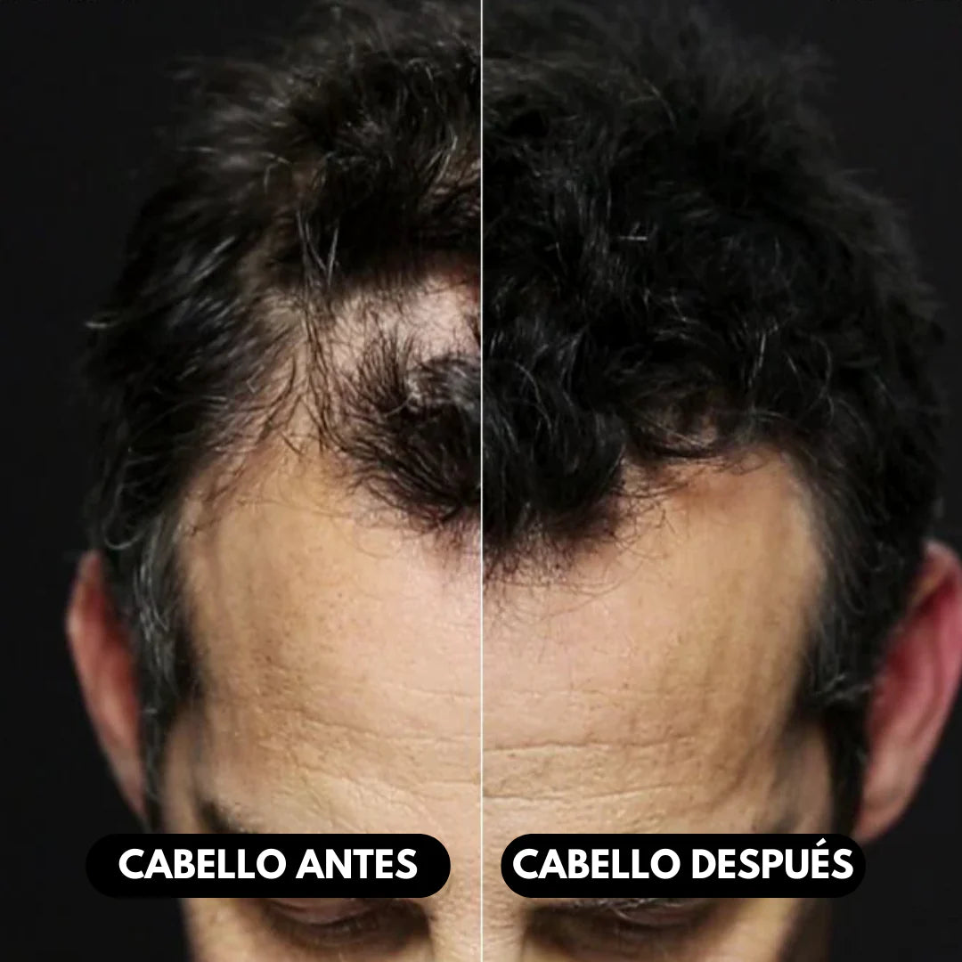 Fibra Capilar ¡Recupera Tu Cabello en Segundos sin Cirugías!