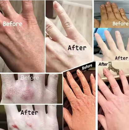 Adiós Manchas Oscuras.